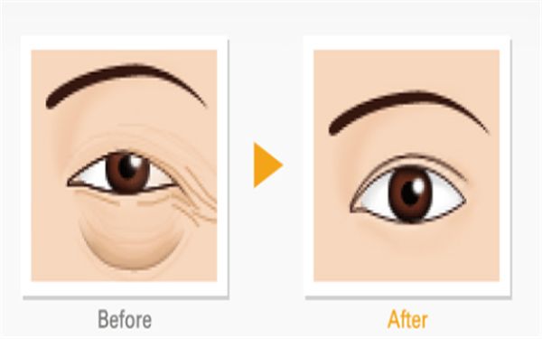 哈爾濱隆胸修復(fù)醫(yī)院排名及口碑對(duì)比，哪家專業(yè)又靠譜？