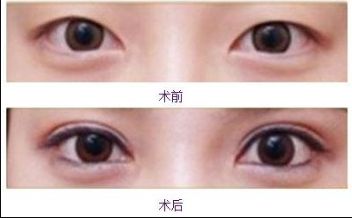 合肥美白針哪家醫(yī)院好？排名前幾位的合肥專業(yè)美膚診所推薦