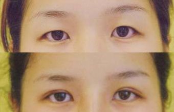 大慶微整形醫(yī)院哪家好？頂級專家為您解讀微整形醫(yī)院選擇指南！