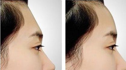 珠海市哪家整形醫(yī)院口碑好？專業(yè)整形醫(yī)院推薦排行揭曉