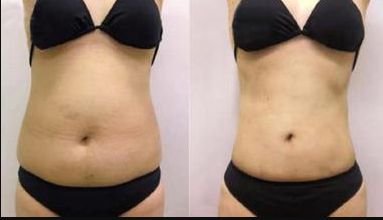 太原哪家醫(yī)院眼袋整形好？優(yōu)質專家推薦