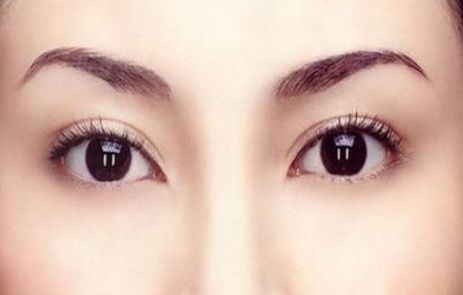 中國哪家假體隆胸醫(yī)院好？2023排名TOP10及專家推薦