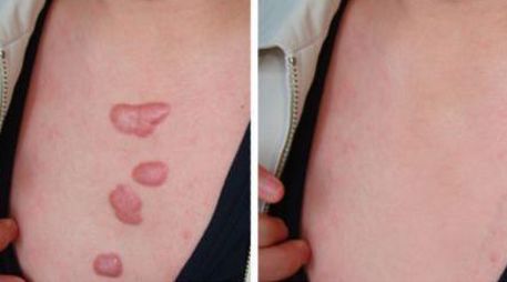 鄭州市哪家美容醫(yī)院好？優(yōu)質(zhì)專業(yè)醫(yī)療服務(wù)等你來咨詢！