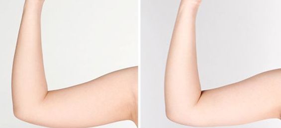 北京豐胸整形醫(yī)院排名及口碑調(diào)查