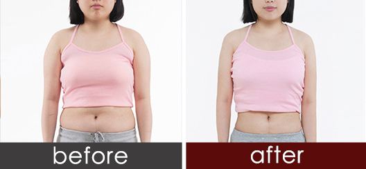 2023昆明切開(kāi)法重瞼術(shù)正規(guī)專(zhuān)家榜單10強(qiáng)(張佩蓮、戴榮琴、賈虹實(shí)力優(yōu)異，值得信賴(lài)！)