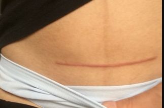 如何選擇新疆做胎記醫(yī)院，哪家好？