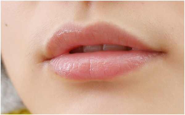 2023鹽城眉間紋打玻尿酸前十強醫(yī)生排名榜(葛乃航、杜康、于海洲人氣口碑實力三合一推薦)