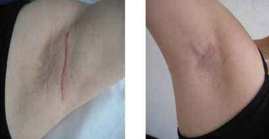 深圳激光美容醫(yī)院排名及口碑哪家好？