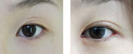 汕頭市整形醫(yī)院有哪些？哪家整形醫(yī)院在汕頭市口碑好？