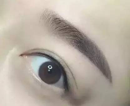 佰華利董萍的面部脂肪填充經(jīng)驗，展現(xiàn)自然少女感