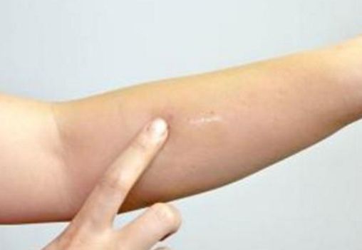 蘇州吸脂瘦身醫(yī)院哪家好？選個最適合你的專業(yè)醫(yī)療機(jī)構(gòu)