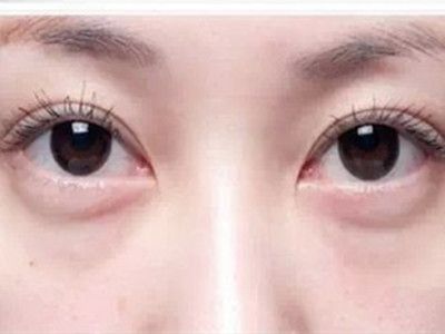 寧波祛斑哪家醫(yī)院好？精選寧波祛斑專業(yè)醫(yī)院推薦！