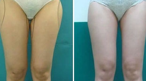 揭陽激光美容醫(yī)院哪家好？選擇揭陽最佳激光美容醫(yī)院的7個(gè)關(guān)鍵要素！