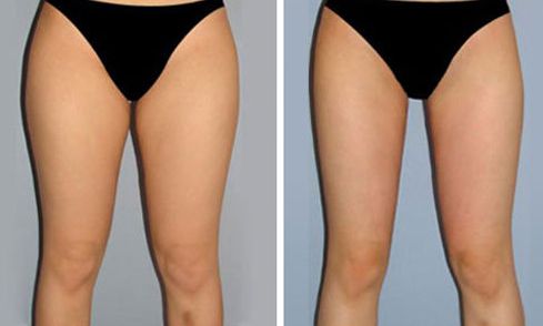 重慶美萊整形美容醫(yī)院口碑如何？醫(yī)生名單和特色項目都有什么？