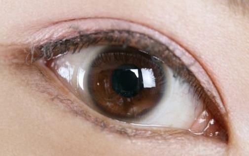 趙月強(qiáng)整雙眼皮手術(shù)經(jīng)驗(yàn)分享！專家背景資料+展示效果，迷人眼妝攻略免費(fèi)分享！