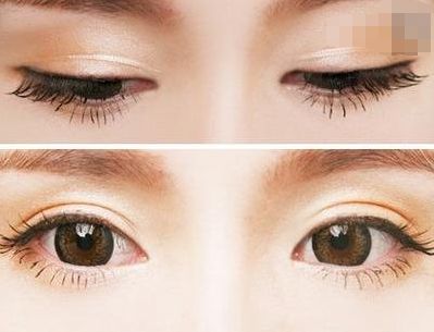 西寧豐胸整形醫(yī)院排名前三，專業(yè)醫(yī)生推薦！