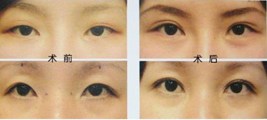 揭秘佛山哪家整形醫(yī)院吸脂好？導醫(yī)全解析、患者口碑高，信賴度高！