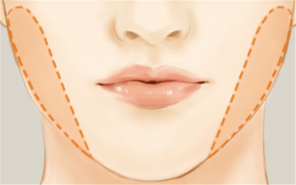 寧波海曙美萊醫(yī)療美容整形醫(yī)院醫(yī)生技術(shù)靠譜嗎？手術(shù)項(xiàng)目有哪些呢？