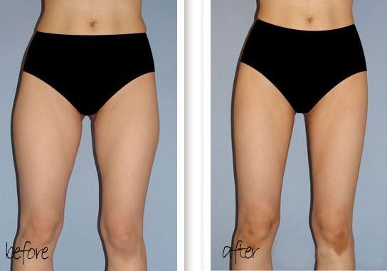 合肥隆鼻好整形醫(yī)院是哪家？綜合口碑來(lái)推薦！