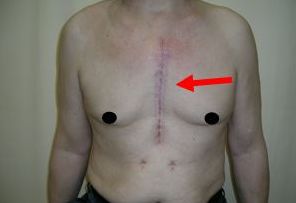 福州果酸換膚哪家醫(yī)院好？