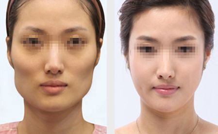 上海祛痘排名前十的醫(yī)院推薦