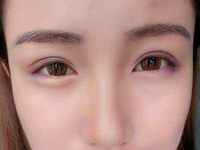 2023鄭州小切口去眼周紋醫(yī)生TOP10強(qiáng)上榜名單(何英杰、袁愷陽、池凱在榜內(nèi))