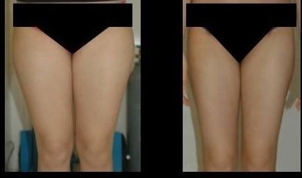 南京做拉皮哪家醫(yī)院好？排名靠前的南京做拉皮醫(yī)院有哪些？