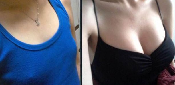 福州鼻梁手術(shù)哪家醫(yī)院好？淺析福州頂級(jí)整形醫(yī)院鼻部整形技術(shù)