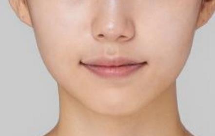 2023濟(jì)南膠原蛋白注射墊額頭醫(yī)生排名榜top10強(qiáng)(平金磊、黃志祥、王玉柱干貨帖收藏)