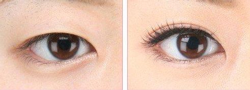 陜西省郴州市有哪些醫(yī)院值得推薦呢？