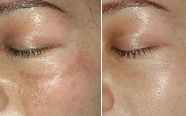 廣州領(lǐng)銜！全新發(fā)布隆鼻專家排行榜！盤點(diǎn)醫(yī)生資料！