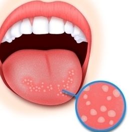 2023重慶川字紋填充自體脂肪口碑榜醫(yī)生(李正形、鄧誠、王琪斌誰個更出色！)