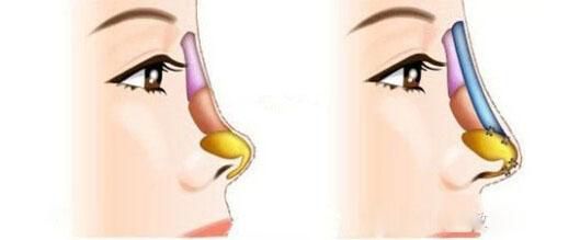 全國哪家醫(yī)院祛斑好？10家值得信賴的專業(yè)醫(yī)院推薦