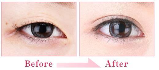 2023新鄉(xiāng)玻尿酸去除黑眼圈權威醫(yī)生評分TOP10(魏作明、井素芳、魏作明實力口碑沒一個差的)