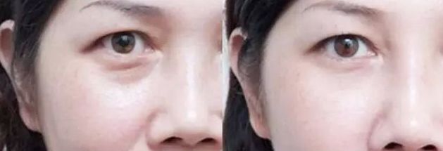 保定市整形外科哪家好？2023年最新榜單及專家推薦！