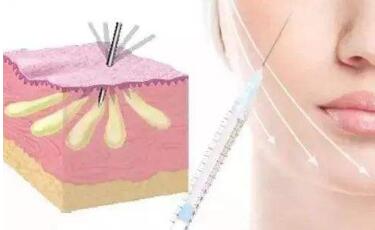 廈門時(shí)光整形美容專家為你呈現(xiàn)完美雙眼皮