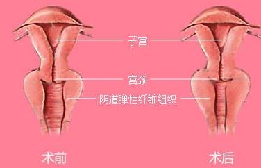 長沙靠譜矯正醫(yī)院哪家好？解答你所有的疑慮！