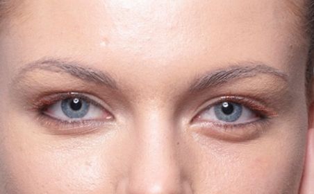 深圳哪家醫(yī)院的埋線減肥效果最好？