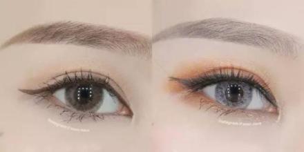 2023杭州面部填充眼紋醫(yī)生前10位上榜名單(馬瑞宣、王正云、司婷婷領(lǐng)銜榜首~)