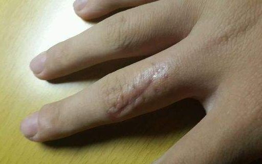 衢州市整形醫(yī)院比較好的有哪些？