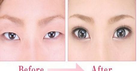 貴陽鼻部整形醫(yī)院哪家好？綜合排名及用戶評(píng)價(jià)一覽