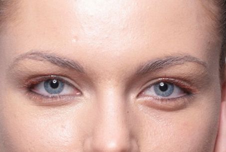 成都有哪些專業(yè)的祛斑祛痘印機(jī)構(gòu)值得推薦？