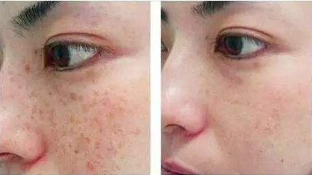 包頭哪家醫(yī)院做隆胸好？全面解析包頭市評(píng)價(jià)最高的隆胸醫(yī)院