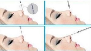 四川哪家醫(yī)院治療狐臭效果好，口碑最佳？