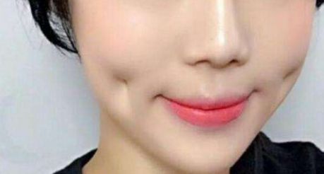 上海超聲刀哪家醫(yī)院做得好？專家推薦，超聲刀手術(shù)最佳選擇