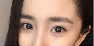 珠海市祛斑好的醫(yī)院哪家靠譜？