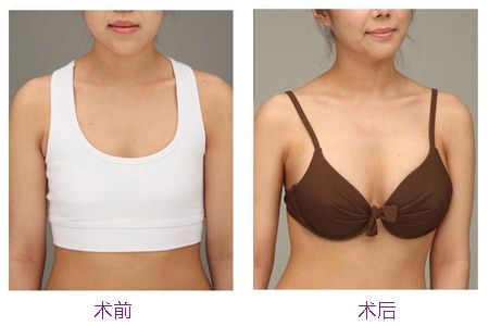 2023中山微電波拉皮除皺專(zhuān)家TOP10(胡可斌、肖鵬飛、鄭秋菊出名靠譜！)