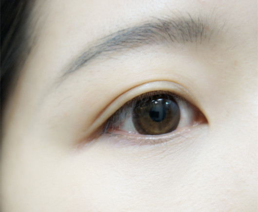 2023承德熊貓針去川字紋口碑排名前十強(qiáng)醫(yī)生(堵頂云、魏國(guó)祥、魏國(guó)祥個(gè)個(gè)都是實(shí)力派代表！)