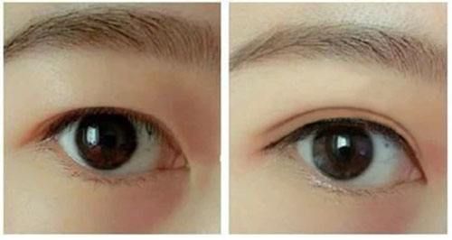 2023秦皇島深藍(lán)射頻面部排行前十強(qiáng)的醫(yī)生(王強(qiáng)、劉運(yùn)濤、池建強(qiáng)推薦指數(shù)五顆星)