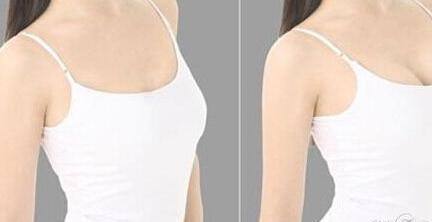 中國醫(yī)科大學(xué)附屬醫(yī)院美容科卓越醫(yī)生名單，親測案例圖詳解！